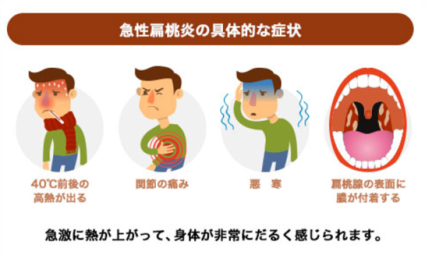のどの病気 にしかわ耳鼻咽喉科 のどの病気 にしかわ耳鼻咽喉科